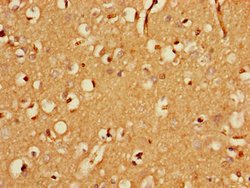 Invitrogen FBXO25 Polyclonal Antibody 100 &mu;g | Buy Online | Invitrogen&trade; | Fisher Scientific