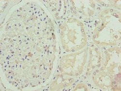 Invitrogen FBXO25 Polyclonal Antibody 100 &mu;g | Buy Online | Invitrogen&trade; | Fisher Scientific