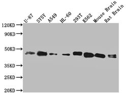 Invitrogen SPPL3 Polyclonal Antibody 100 &mu;g; Unconjugated:Antibodies,