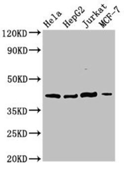 Invitrogen SPPL3 Polyclonal Antibody 100 &mu;g; Unconjugated:Antibodies,