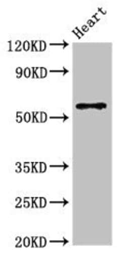 Invitrogen YLAT2 Polyclonal Antibody 100 &mu;g | Buy Online | Invitrogen&trade; | Fisher Scientific