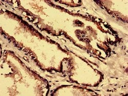 Invitrogen CPNE4 Polyclonal Antibody 100 &mu;g; Unconjugated:Antibodies,