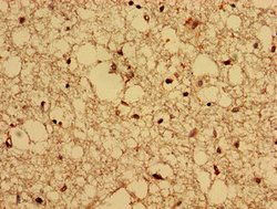 Invitrogen CPNE4 Polyclonal Antibody 100 &mu;g; Unconjugated:Antibodies,