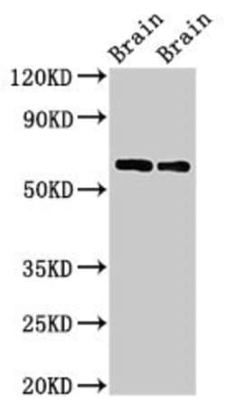 Invitrogen CPNE4 Polyclonal Antibody 100 &mu;g; Unconjugated:Antibodies,
