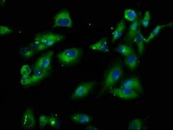 Invitrogen PIK3IP1 Polyclonal Antibody 100 μg; Unconjugated:Antibodies,