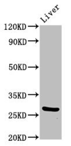 Invitrogen PIK3IP1 Polyclonal Antibody 100 μg; Unconjugated:Antibodies,
