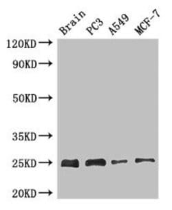Invitrogen APOPT1 Polyclonal Antibody 100 μg; Unconjugated:Antibodies,