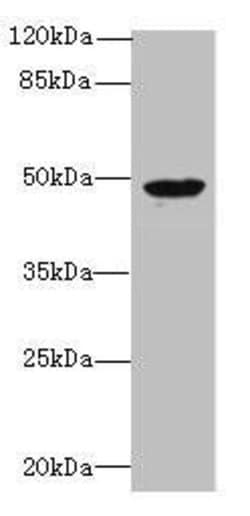 Invitrogen RBM41 Polyclonal Antibody 100 &mu;g; Unconjugated:Antibodies,