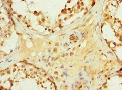 Invitrogen HHIP Polyclonal Antibody 100 &mu;L; Unconjugated:Antibodies,