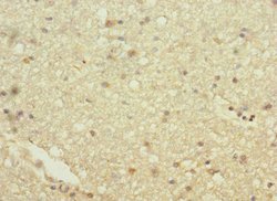 Invitrogen HHIP Polyclonal Antibody 100 &mu;L; Unconjugated:Antibodies,