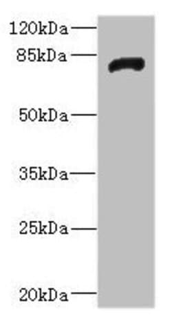 Invitrogen HHIP Polyclonal Antibody 100 &mu;L; Unconjugated:Antibodies,