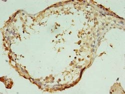 Invitrogen C7orf62 Polyclonal Antibody 100 &mu;g; Unconjugated:Antibodies,