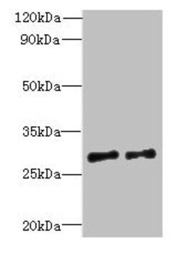 Invitrogen C7orf62 Polyclonal Antibody 100 &mu;g; Unconjugated:Antibodies,