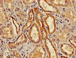 Invitrogen ACMSD Polyclonal Antibody 100 &mu;g; Unconjugated:Antibodies,