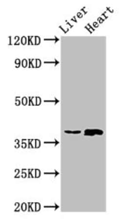 Invitrogen ACMSD Polyclonal Antibody 100 &mu;g; Unconjugated:Antibodies,