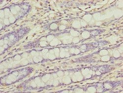 Invitrogen FAM222B Polyclonal Antibody 100 &mu;g; Unconjugated:Antibodies,