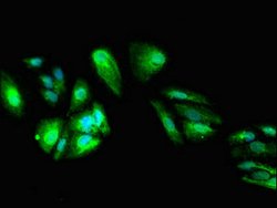 Invitrogen DEPDC1B Polyclonal Antibody 100 μg; Unconjugated:Antibodies,