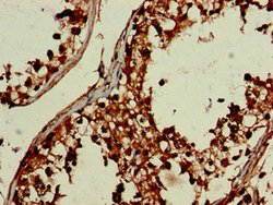 Invitrogen DEPDC1B Polyclonal Antibody 100 μg; Unconjugated:Antibodies,