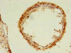 Invitrogen UBLCP1 Polyclonal Antibody 100 &mu;g; Unconjugated:Anticuerpos