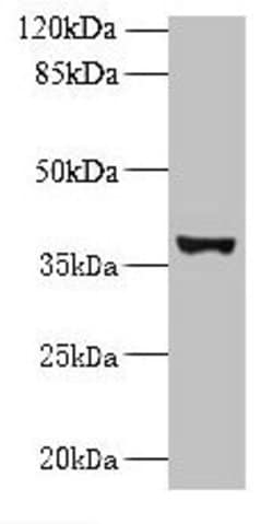 Invitrogen UBLCP1 Polyclonal Antibody 100 &mu;g; Unconjugated:Anticuerpos
