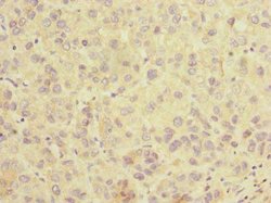 Invitrogen SLC25A36 Polyclonal Antibody 100 μg; Unconjugated:Antibodies,