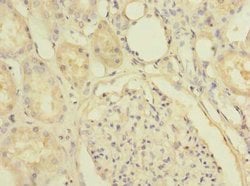 Invitrogen SLC25A36 Polyclonal Antibody 100 μg; Unconjugated:Antibodies,