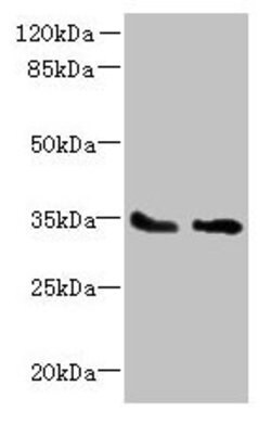 Invitrogen SLC25A36 Polyclonal Antibody 100 μg; Unconjugated:Antibodies,