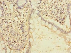 Invitrogen FAM86A Polyclonal Antibody 100 &mu;g; Unconjugated:Antibodies,