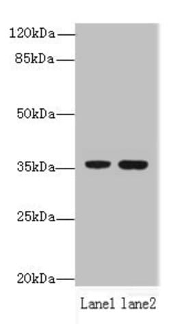 Invitrogen FAM86A Polyclonal Antibody 100 &mu;g; Unconjugated:Antibodies,