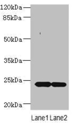 Invitrogen MRAP2 Polyclonal Antibody 100 &mu;g; Unconjugated:Antibodies,