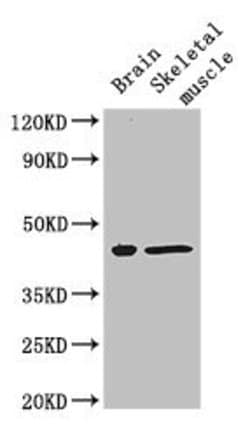 Invitrogen FAM43A Polyclonal Antibody 100 &mu;g; Unconjugated:Antibodies,