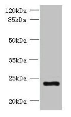 Invitrogen PQLC3 Polyclonal Antibody 100 &mu;g; Unconjugated:Antibodies,