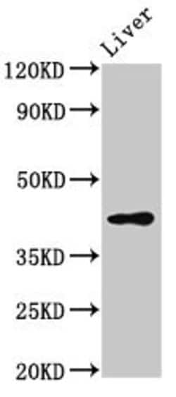 Invitrogen SGMS2 Polyclonal Antibody 100 &mu;g; Unconjugated:Antibodies,