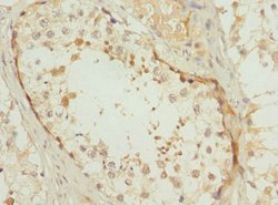 Invitrogen POC1B Polyclonal Antibody 100 &mu;L; Unconjugated:Antibodies,