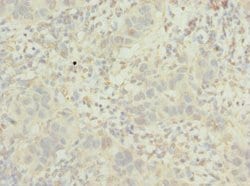 Invitrogen POC1B Polyclonal Antibody 100 &mu;L; Unconjugated:Antibodies,
