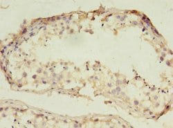 Invitrogen RNF133 Polyclonal Antibody 100 μg; Unconjugated:Antibodies,