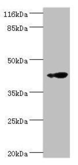 Invitrogen RNF133 Polyclonal Antibody 100 μg; Unconjugated:Antibodies,