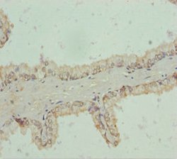 RNF34 Polyclonal Antibody:Antibodies, Polyclonal