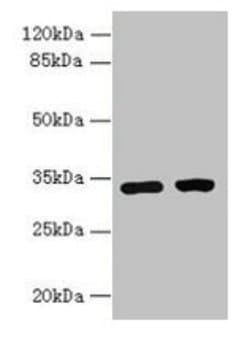 Invitrogen C3orf49 Polyclonal Antibody 100 μg; Unconjugated:Antibodies,