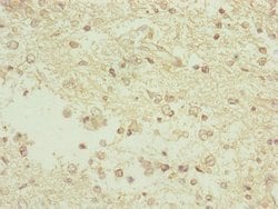 Invitrogen C3orf31 Polyclonal Antibody 100 &mu;L; Unconjugated:Antibodies,