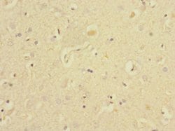 EAF2 Polyclonal Antibody:Antibodies, Polyclonal