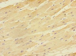 EAF2 Polyclonal Antibody:Antibodies, Polyclonal