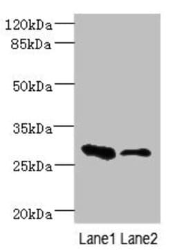 EAF2 Polyclonal Antibody:Antibodies, Polyclonal