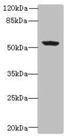 FAPP2 Polyclonal Antibody:Antibodies, Polyclonal