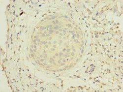 Invitrogen ZHX1 Polyclonal Antibody 100 &mu;g; Unconjugated:Antibodies,