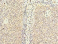 Invitrogen ZHX1 Polyclonal Antibody 100 &mu;g; Unconjugated:Antibodies,