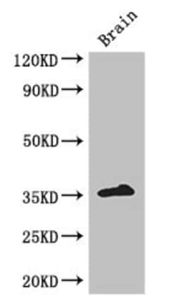 Invitrogen Rex1 Polyclonal Antibody 100 &mu;g; Unconjugated:Antibodies,
