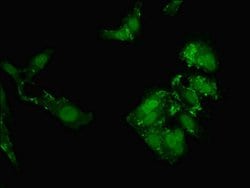 Invitrogen CT112 Polyclonal Antibody 100 &mu;g; Unconjugated:Anticorps,