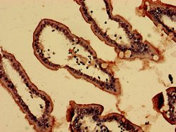 Invitrogen CT112 Polyclonal Antibody 100 &mu;g; Unconjugated:Anticorps,