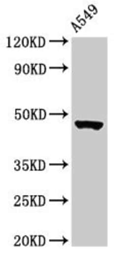 Invitrogen CT112 Polyclonal Antibody 100 &mu;g; Unconjugated:Anticorps,